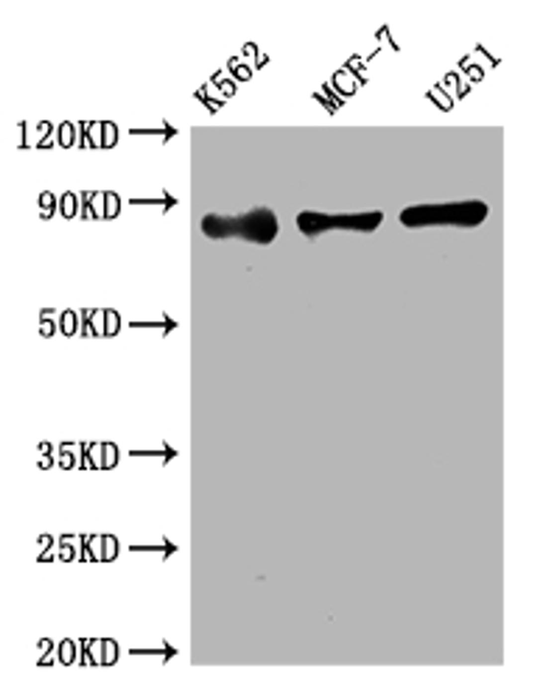 Western Blot. Positive WB detected in: K562 whole cell lysate, MCF-7 whole cell lysate, U251 whole cell lysate. All lanes: IKK beta antibody at 1:2000. Secondary. Goat polyclonal to rabbit IgG at 1/50000 dilution. Predicted band size: 87 kDa. Observed band size: 87 kDa.