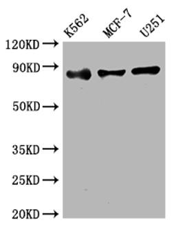 Western Blot. Positive WB detected in: K562 whole cell lysate, MCF-7 whole cell lysate, U251 whole cell lysate. All lanes: IKK beta antibody at 1:2000. Secondary. Goat polyclonal to rabbit IgG at 1/50000 dilution. Predicted band size: 87 kDa. Observed band size: 87 kDa.
