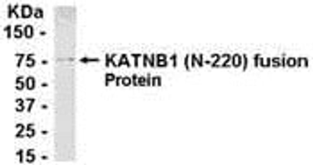 E coli-derived fusion protein as test antigen. Affinity-purified IgY dilution: 1:2000, Goat anti-IgY-HRP dilution: 1:1000. Colorimetric method for signal development.