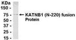 E coli-derived fusion protein as test antigen. Affinity-purified IgY dilution: 1:2000, Goat anti-IgY-HRP dilution: 1:1000. Colorimetric method for signal development.