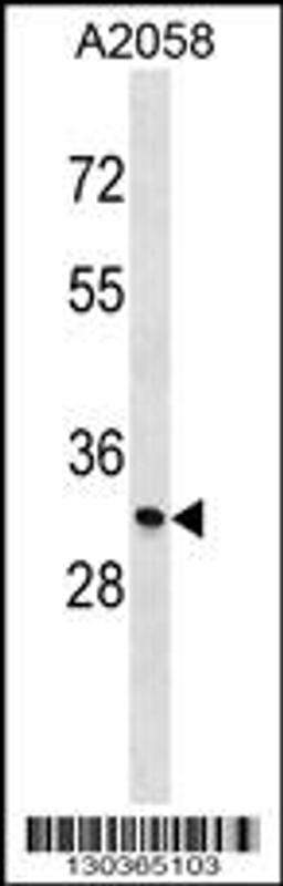 Western blot analysis in A2058 cell line lysates (35ug/lane).