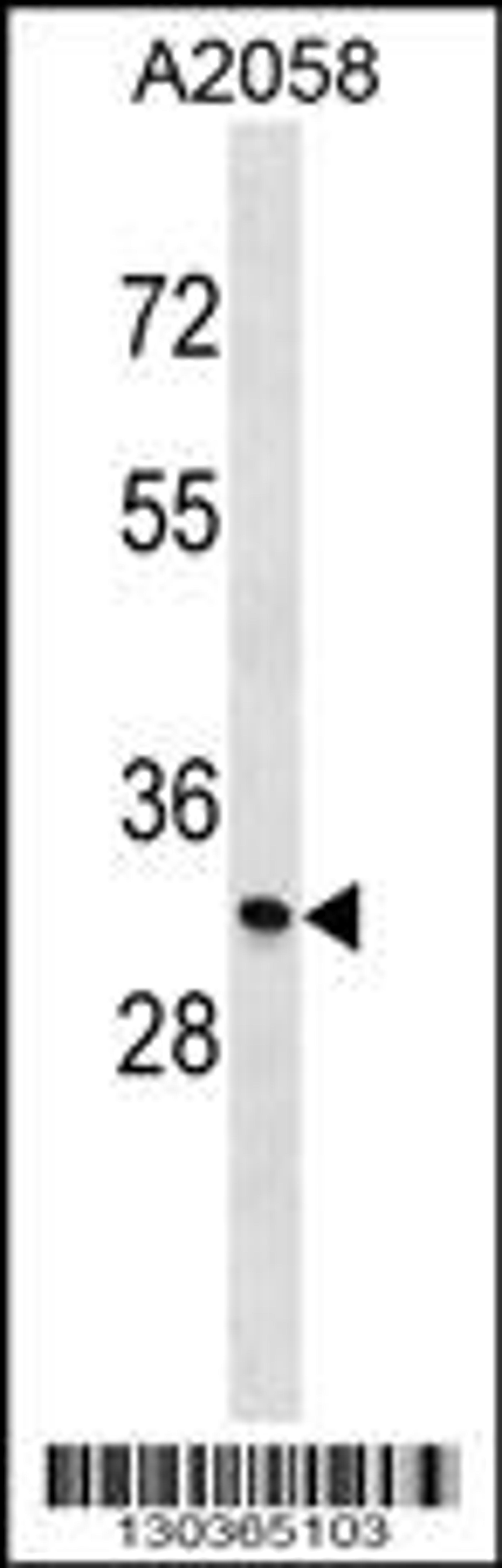 Western blot analysis in A2058 cell line lysates (35ug/lane).