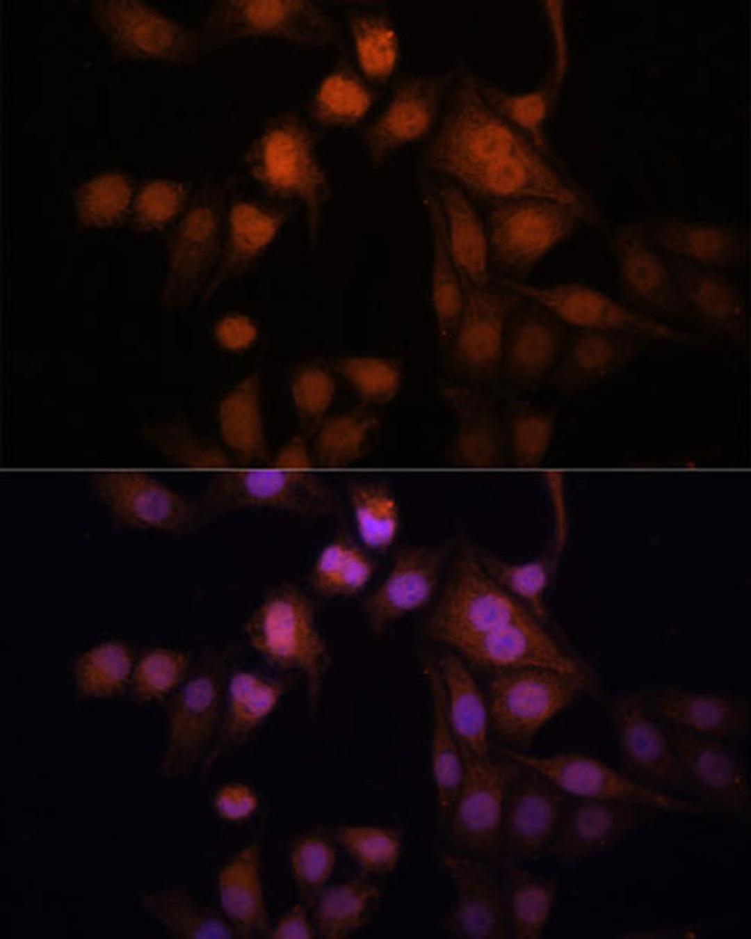 Immunofluorescence - Twist antibody (A7314)