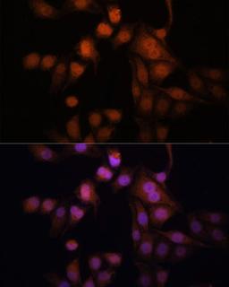 Immunofluorescence - Twist antibody (A7314)