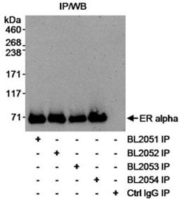 Detection of human Estrogen Receptor Alpha by immunoprecipitation.