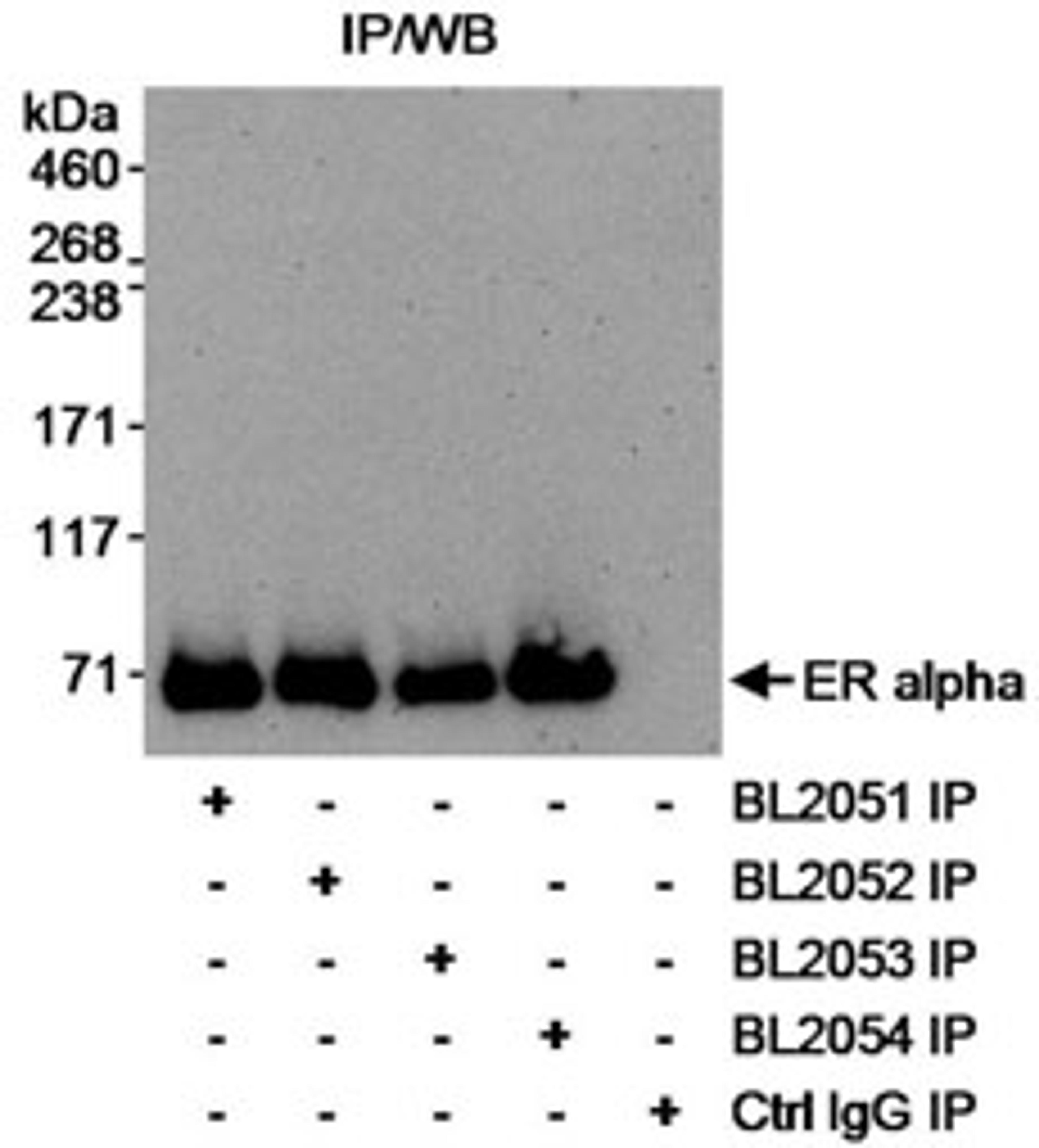 Detection of human Estrogen Receptor Alpha by immunoprecipitation.