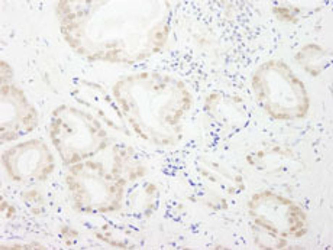 Detection of human GTF3C4/TFIIIC90 by immunohistochemistry.