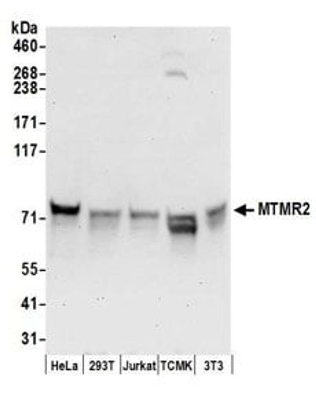 Detection of human and mouse MTMR2 by western blot.