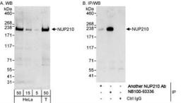 Western Blot: NUP210 Antibody [NB100-93336] - Detection of Human NUP210 on HeLa whole cell lysate. NUP210 was also immunoprecipitated by another rabbit anti-NUP210 antibody.