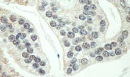 Detection of human RNF40 by immunohistochemistry.