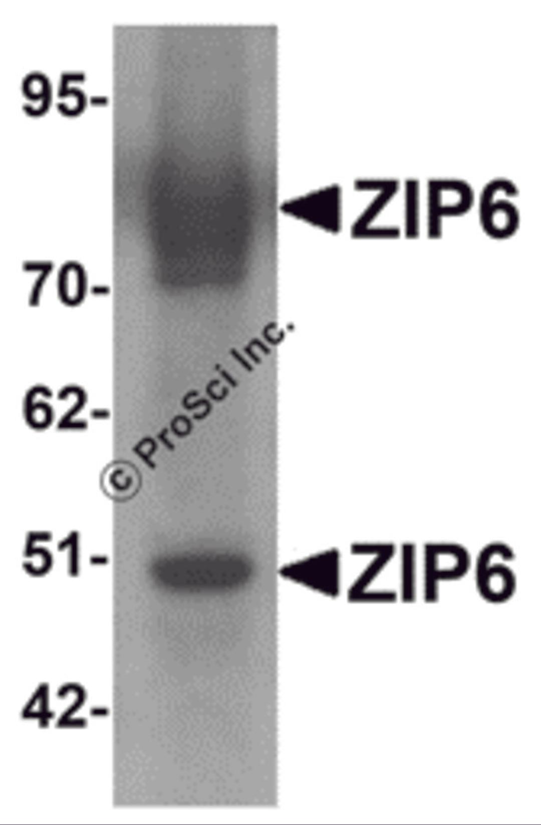 Western blot analysis of ZIP6 in mouse lung tissue lysate with ZIP6 antibody at 1 μg/mL.