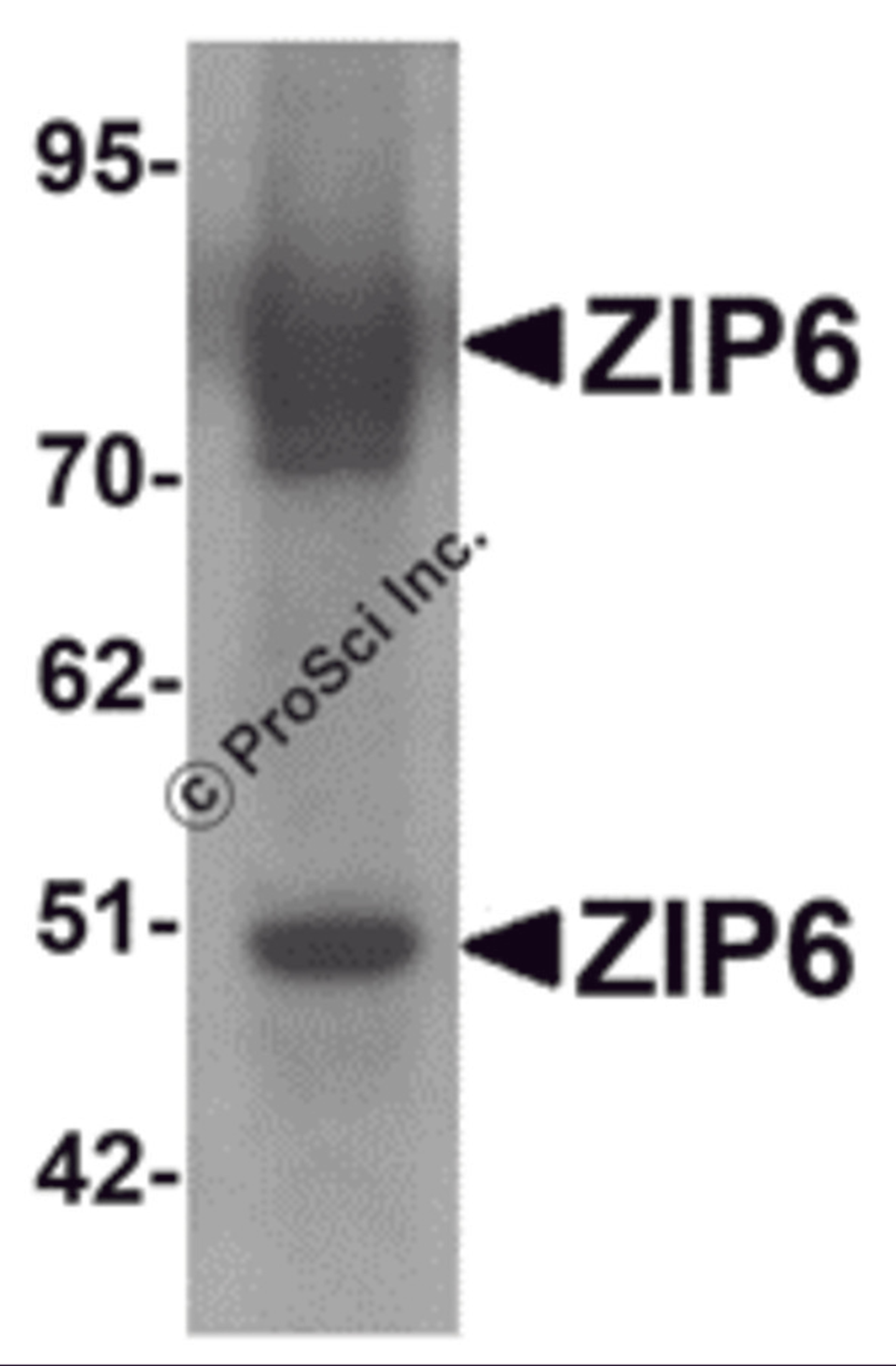 Western blot analysis of ZIP6 in mouse lung tissue lysate with ZIP6 antibody at 1 μg/mL.