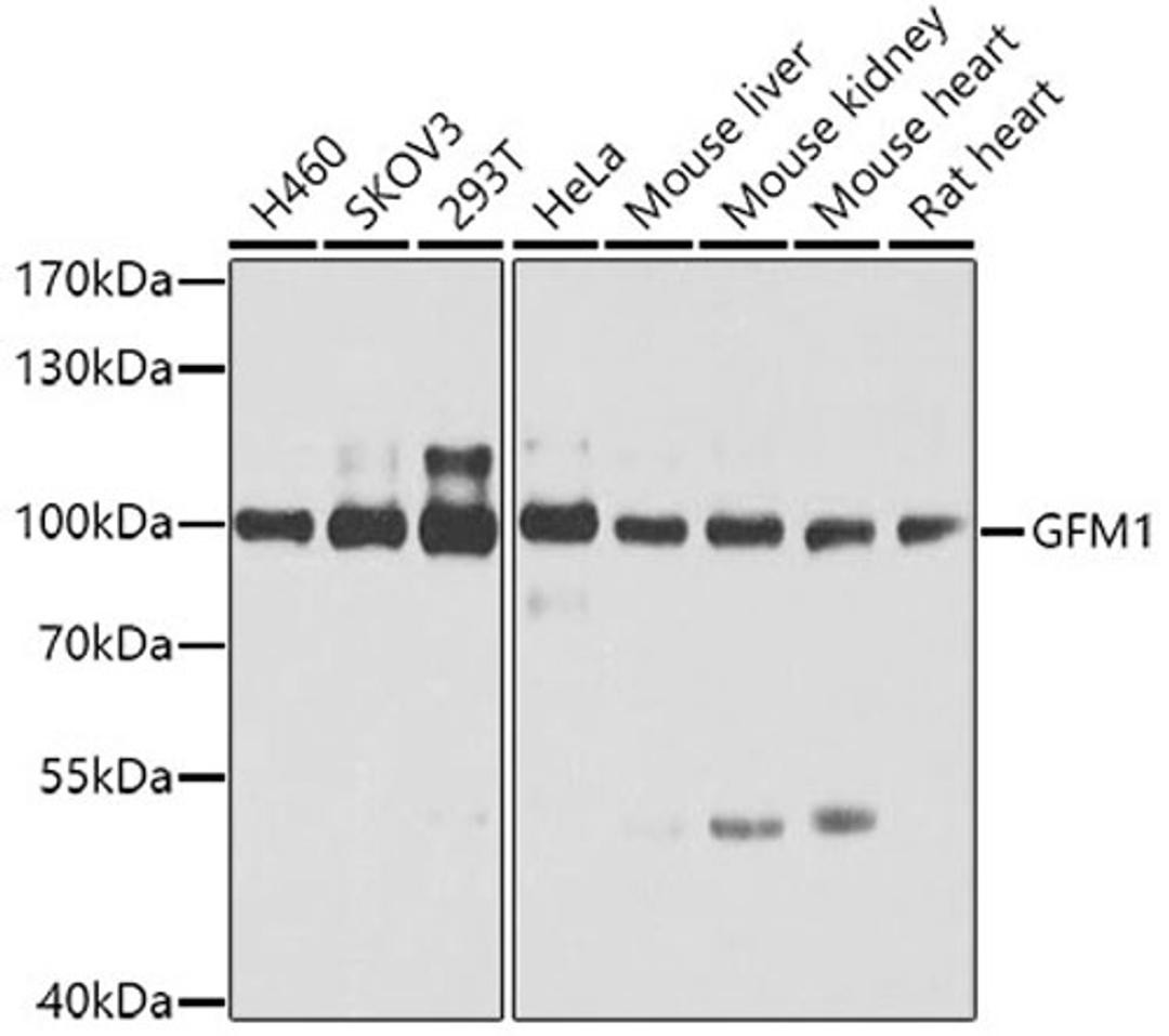 Western blot - GFM1 antibody (A5077)