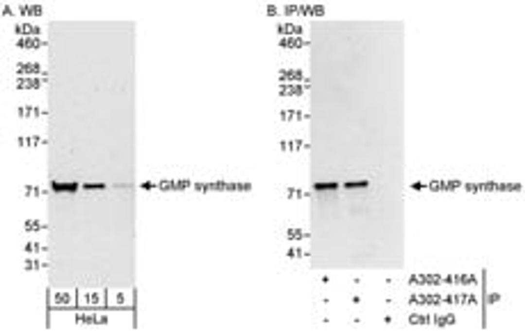 Detection of human GMP synthase by western blot and immunoprecipitation.