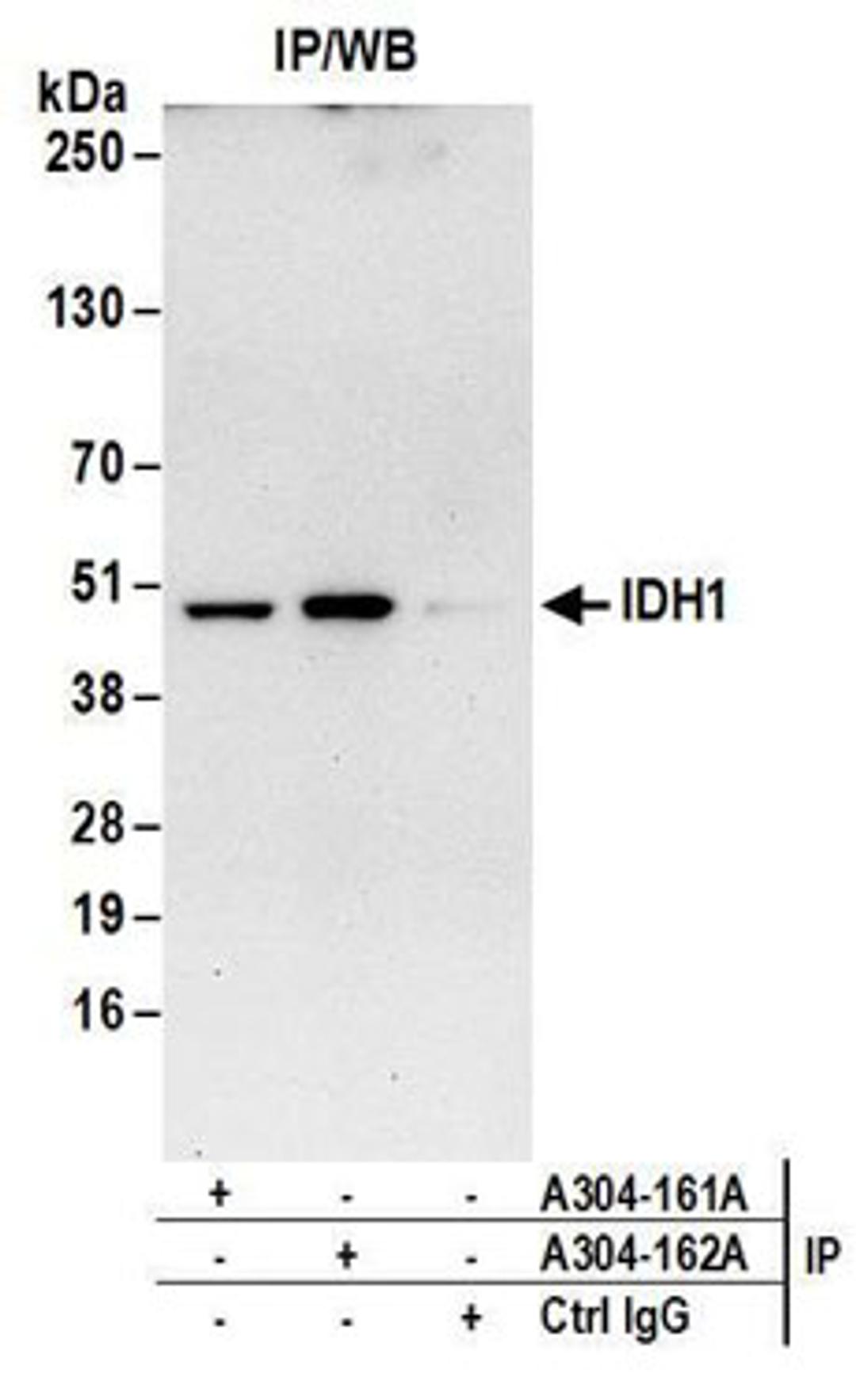 Detection of human IDH1 by western blot of immunoprecipitates.