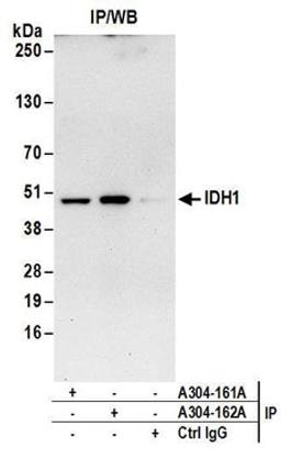 Detection of human IDH1 by western blot of immunoprecipitates.