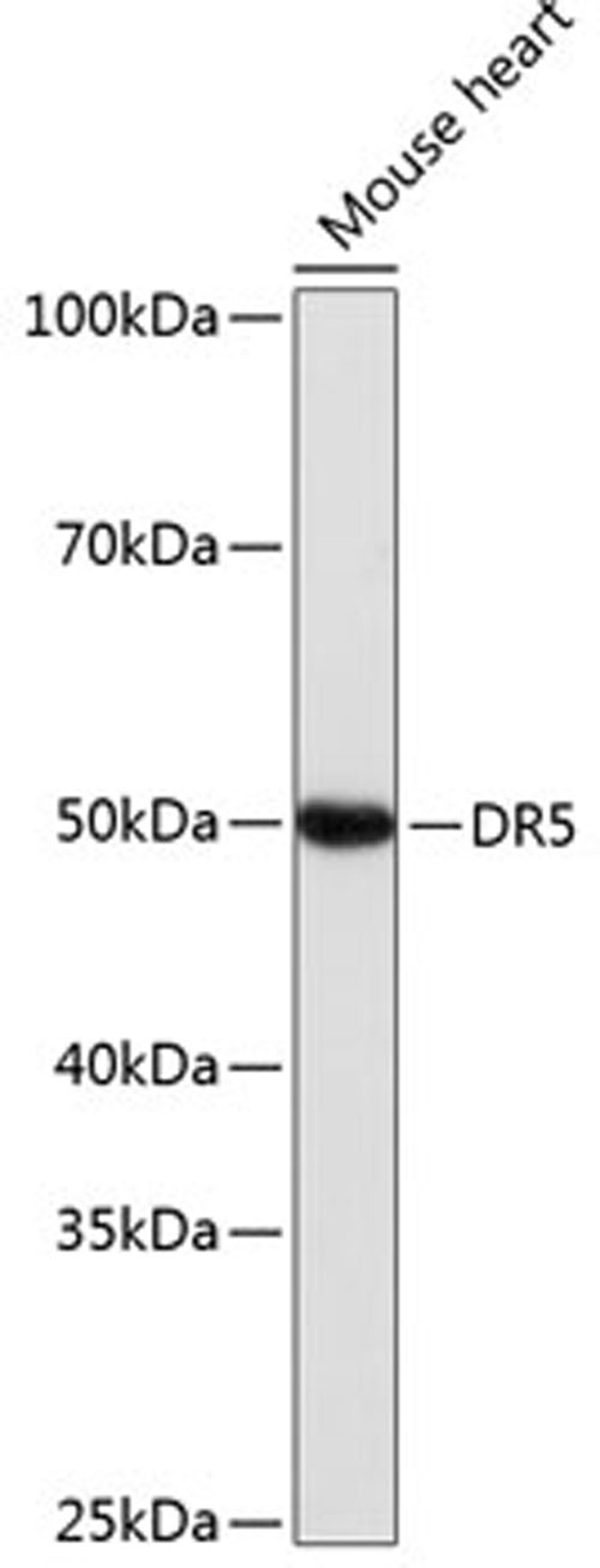 Western blot - DR5 antibody (A19043)