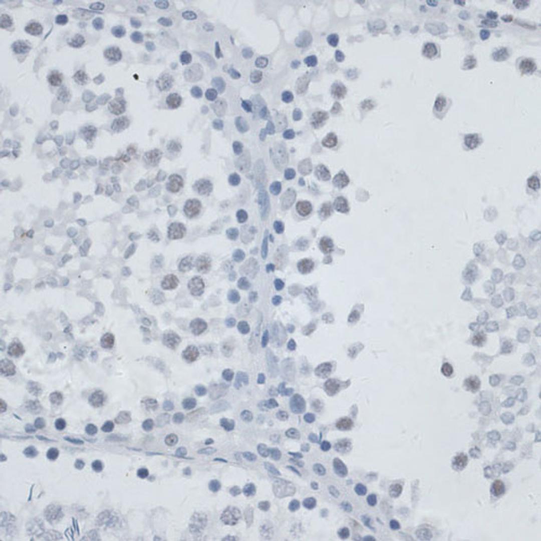 Immunohistochemistry  - MSH6 antibody (A16381)