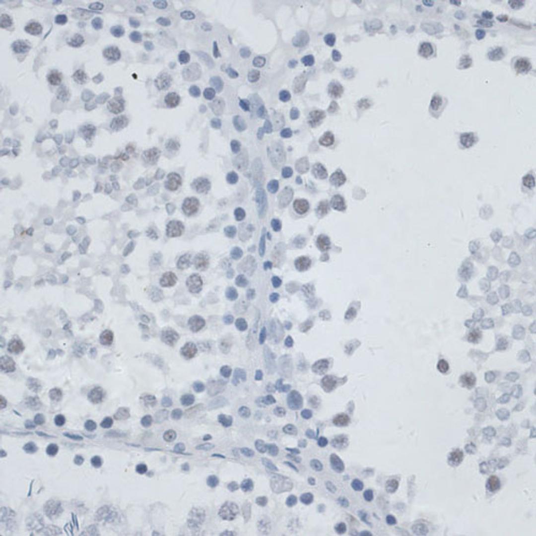 Immunohistochemistry - MSH6 antibody (A16381)