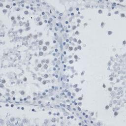 Immunohistochemistry - MSH6 antibody (A16381)