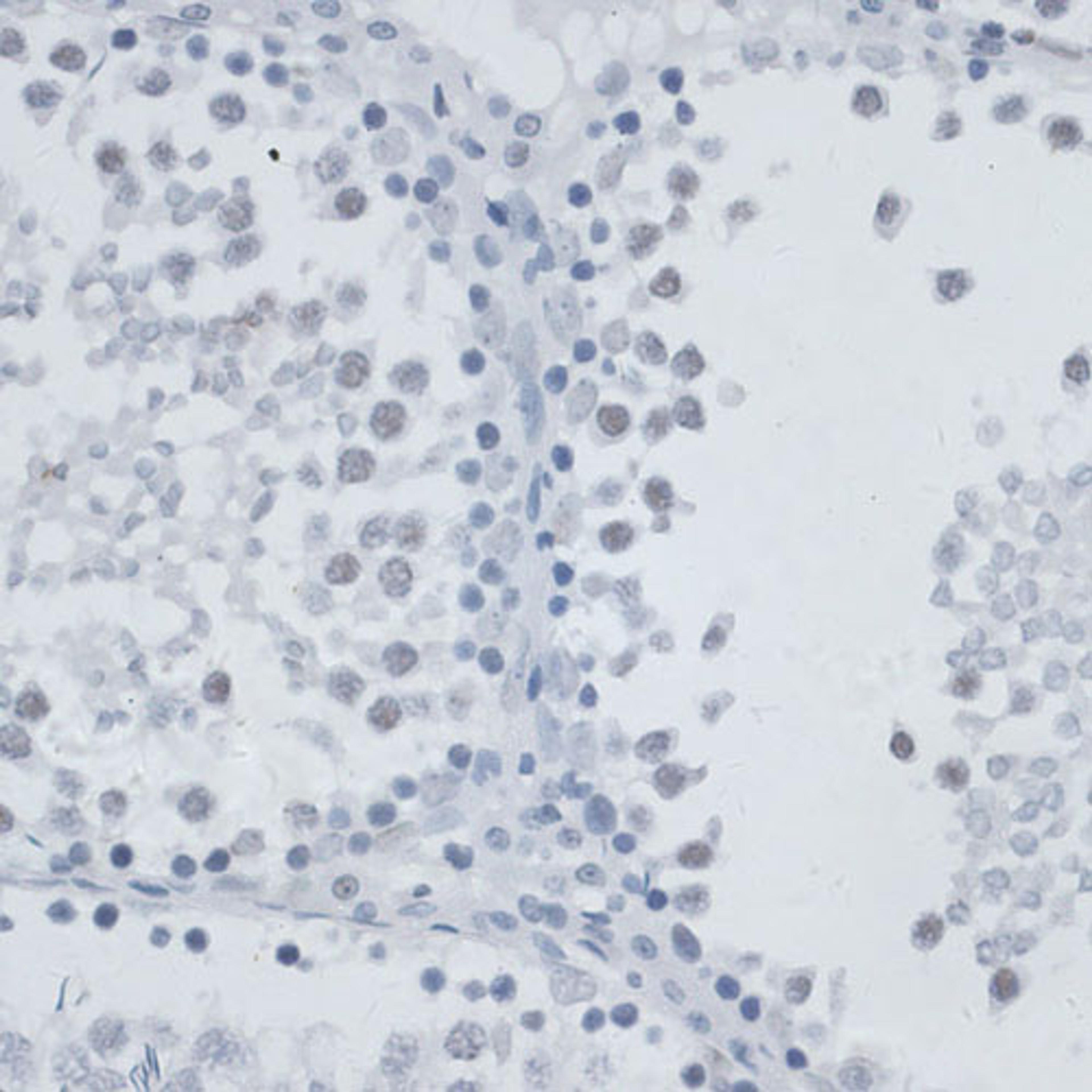 Immunohistochemistry - MSH6 antibody (A16381)