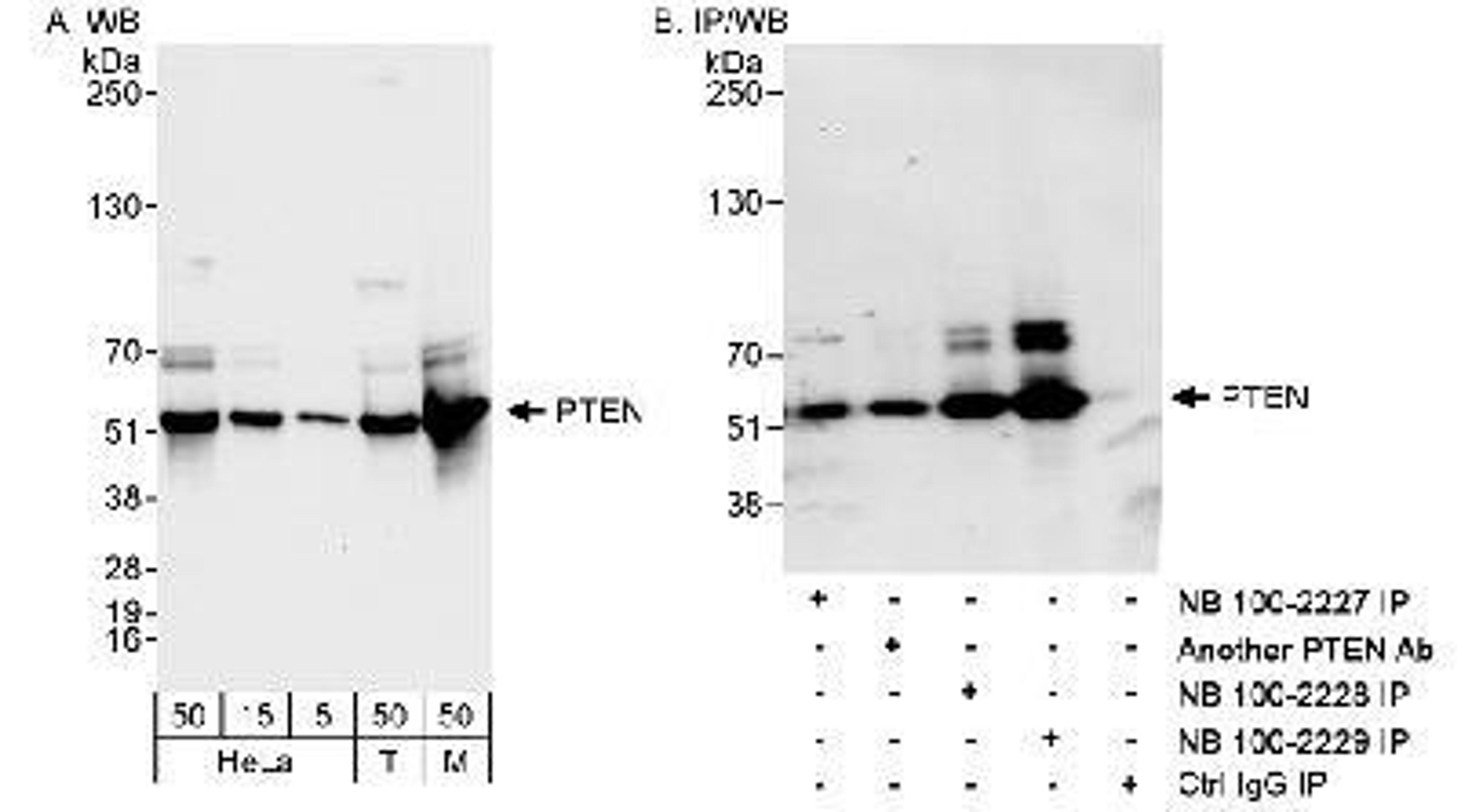 Western Blot: PTEN Antibody [NB100-2229] - Detection of Human and Mouse PTEN on HeLa whole cell lysate using NB100-2229. PTEN was also IPed by rabbit anti-PTEN antibodies NB100-2227, NB100-2228 and another PTEN antibody.