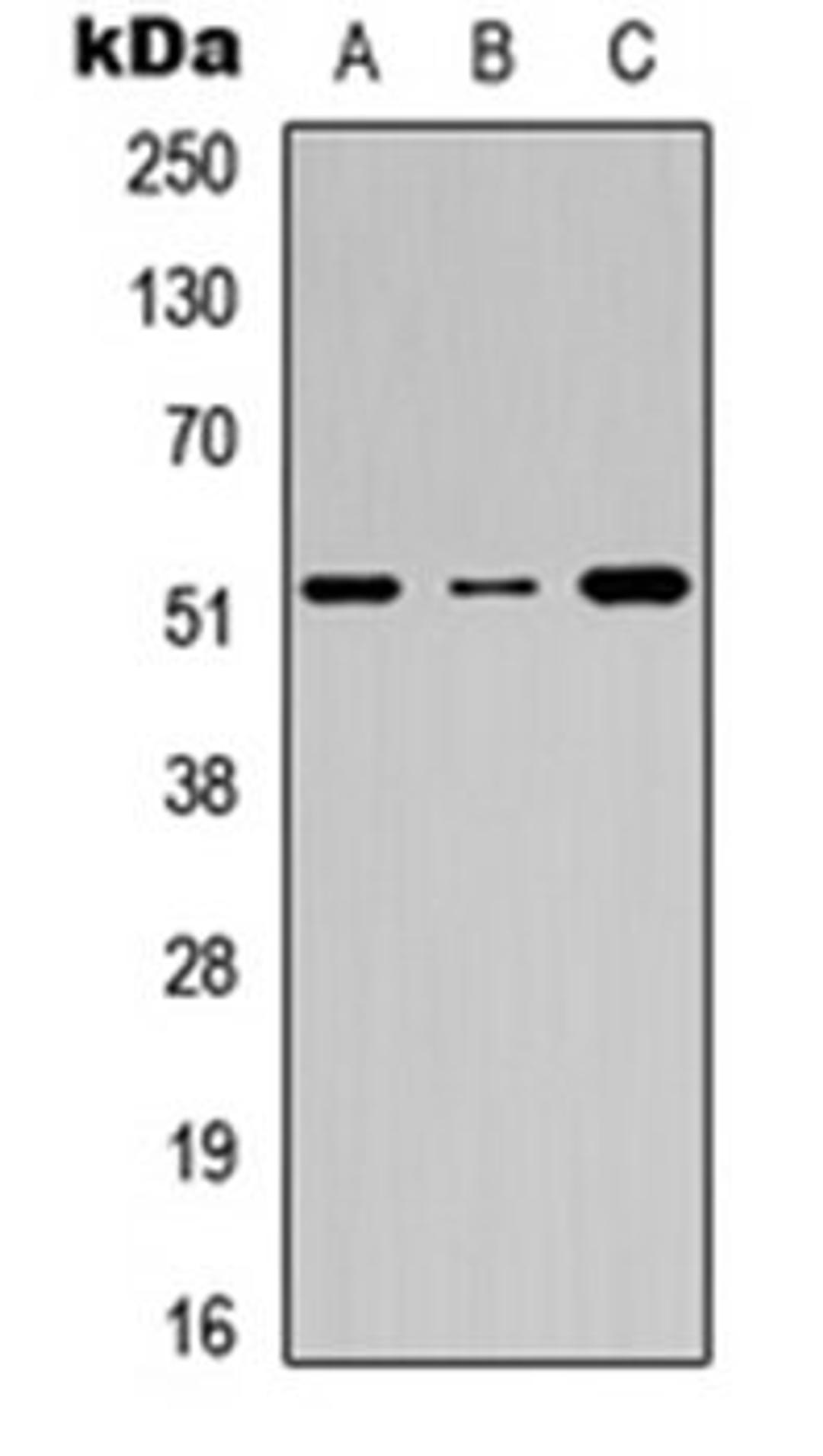 Western blot analysis of A549 (Lane 1), Raw264.7 (Lane 2), H9C2 (Lane 3) whole cell lysates using Factor IX LC antibody