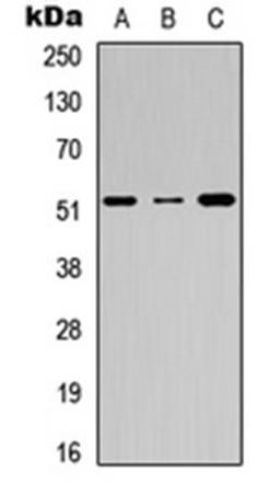 Western blot analysis of A549 (Lane 1), Raw264.7 (Lane 2), H9C2 (Lane 3) whole cell lysates using Factor IX LC antibody