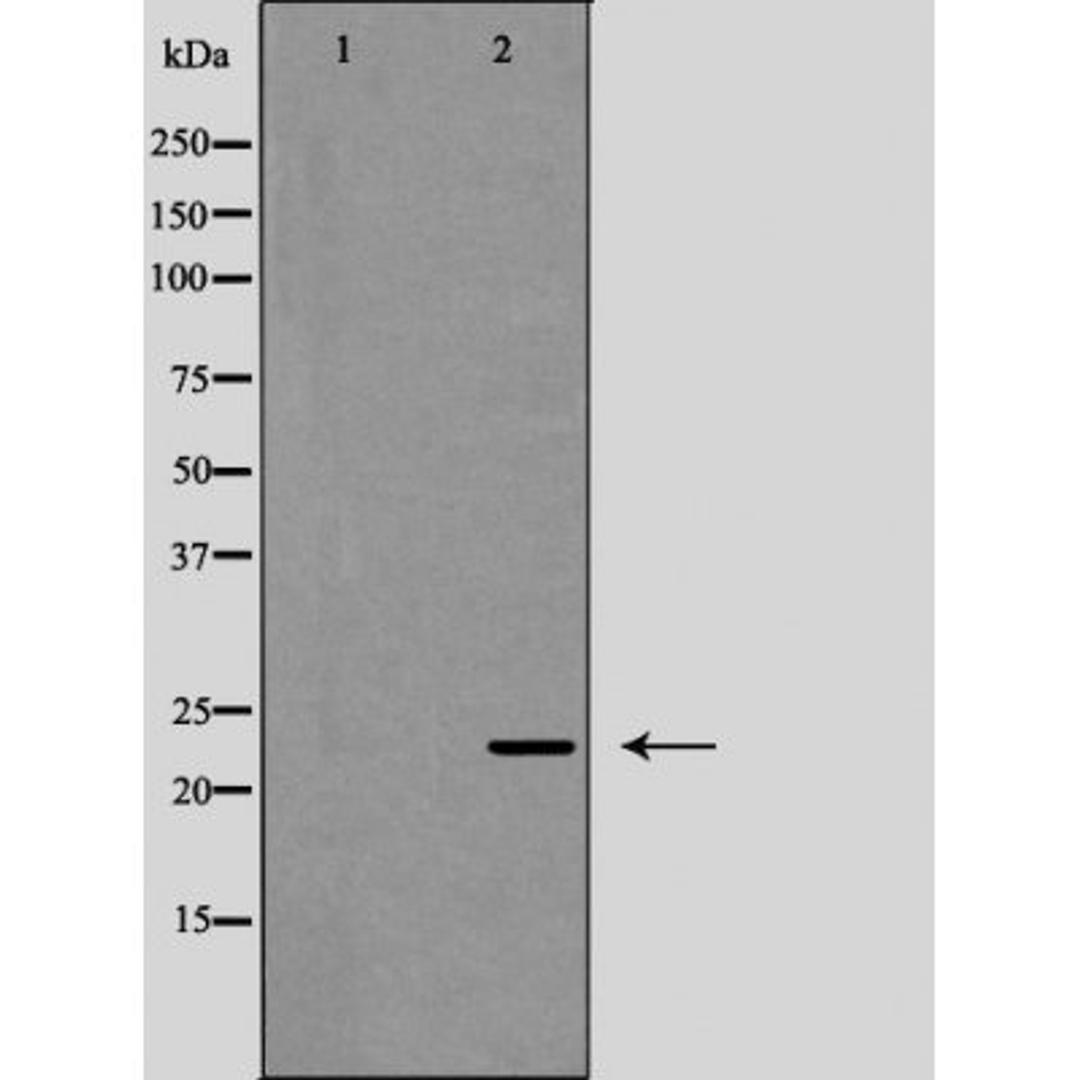 Western blot analysis of HeLa cells using Interleukin 12A antibody