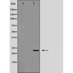 Western blot analysis of HeLa cells using Interleukin 12A antibody