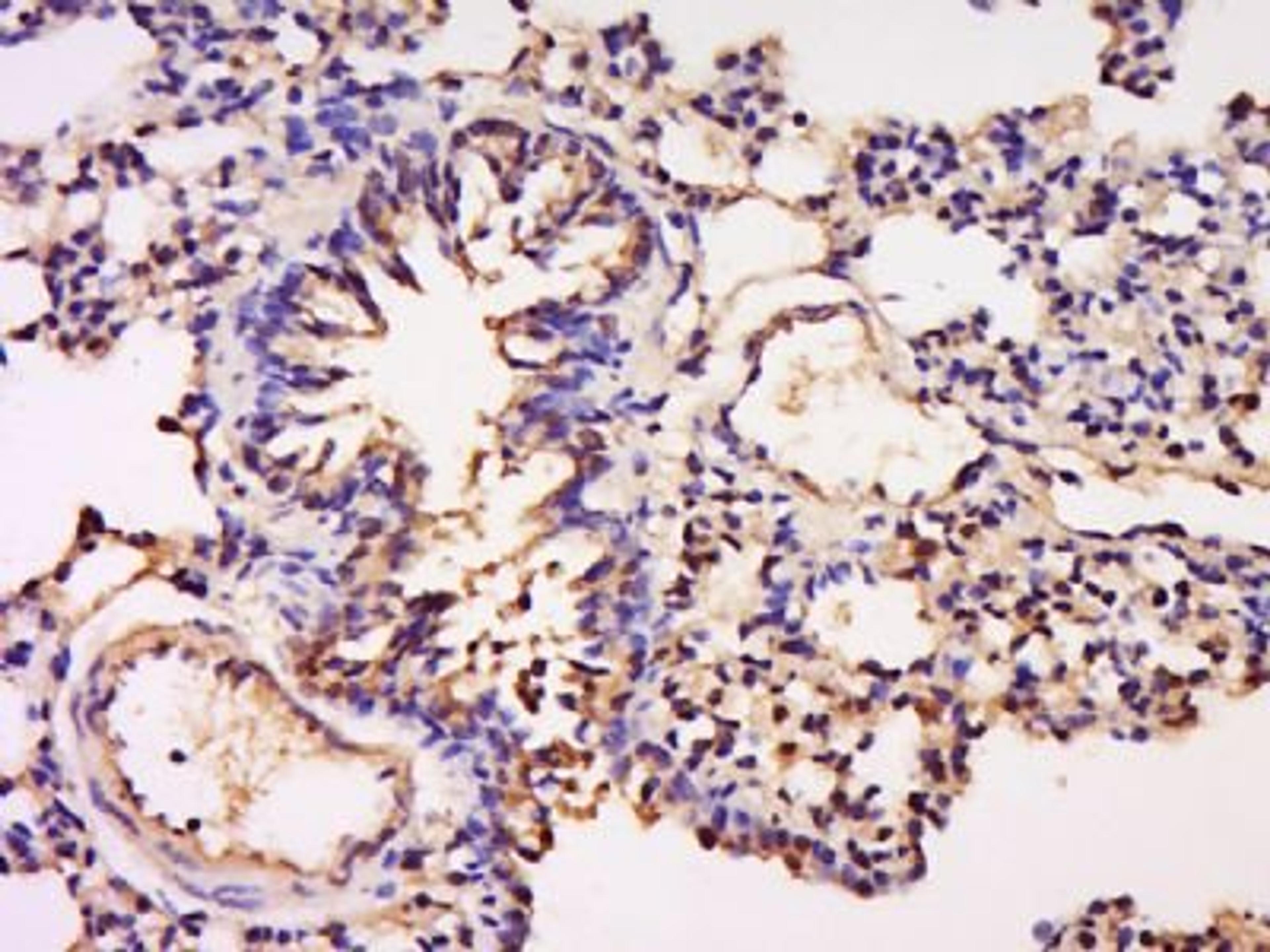 Immunohistochemical staining of Rat lung tissue using GFI1 antibody.