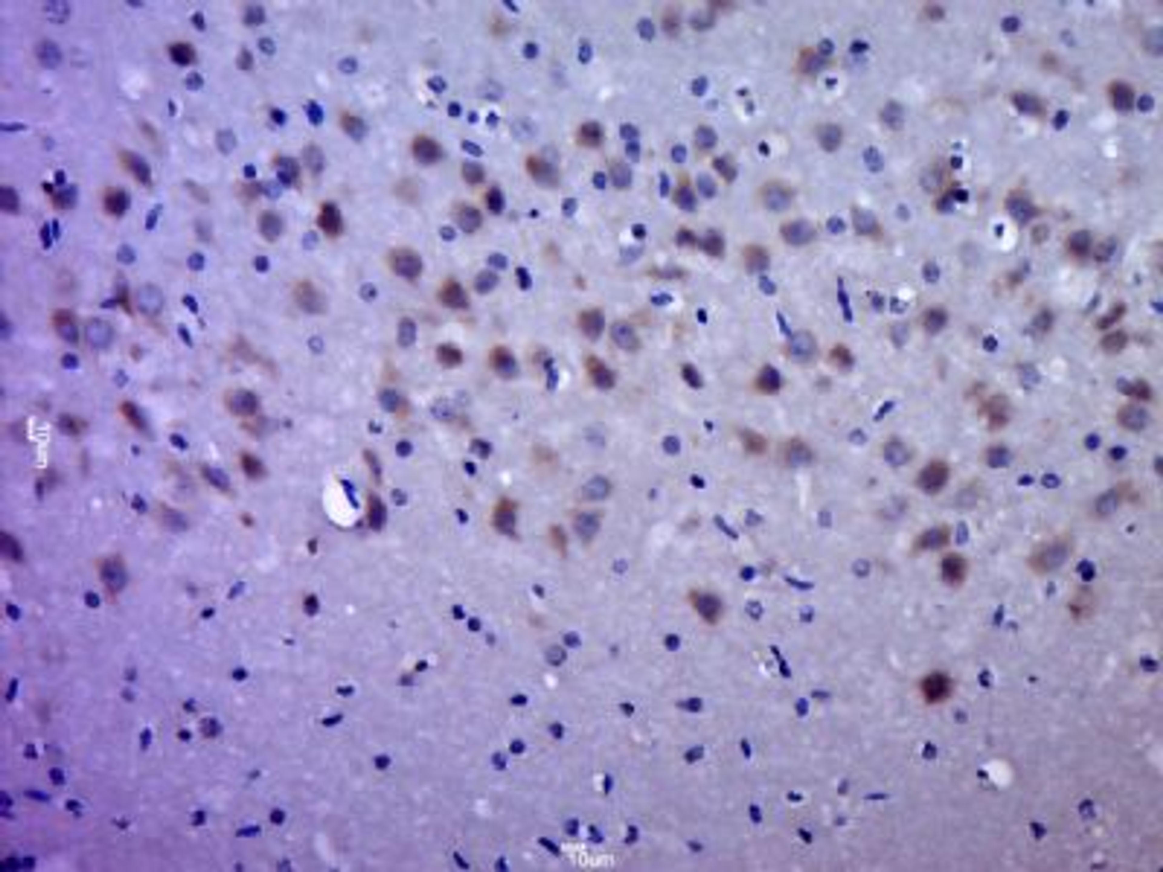 Immunohistochemical staining of rat brain tissue using QPRT antibody.