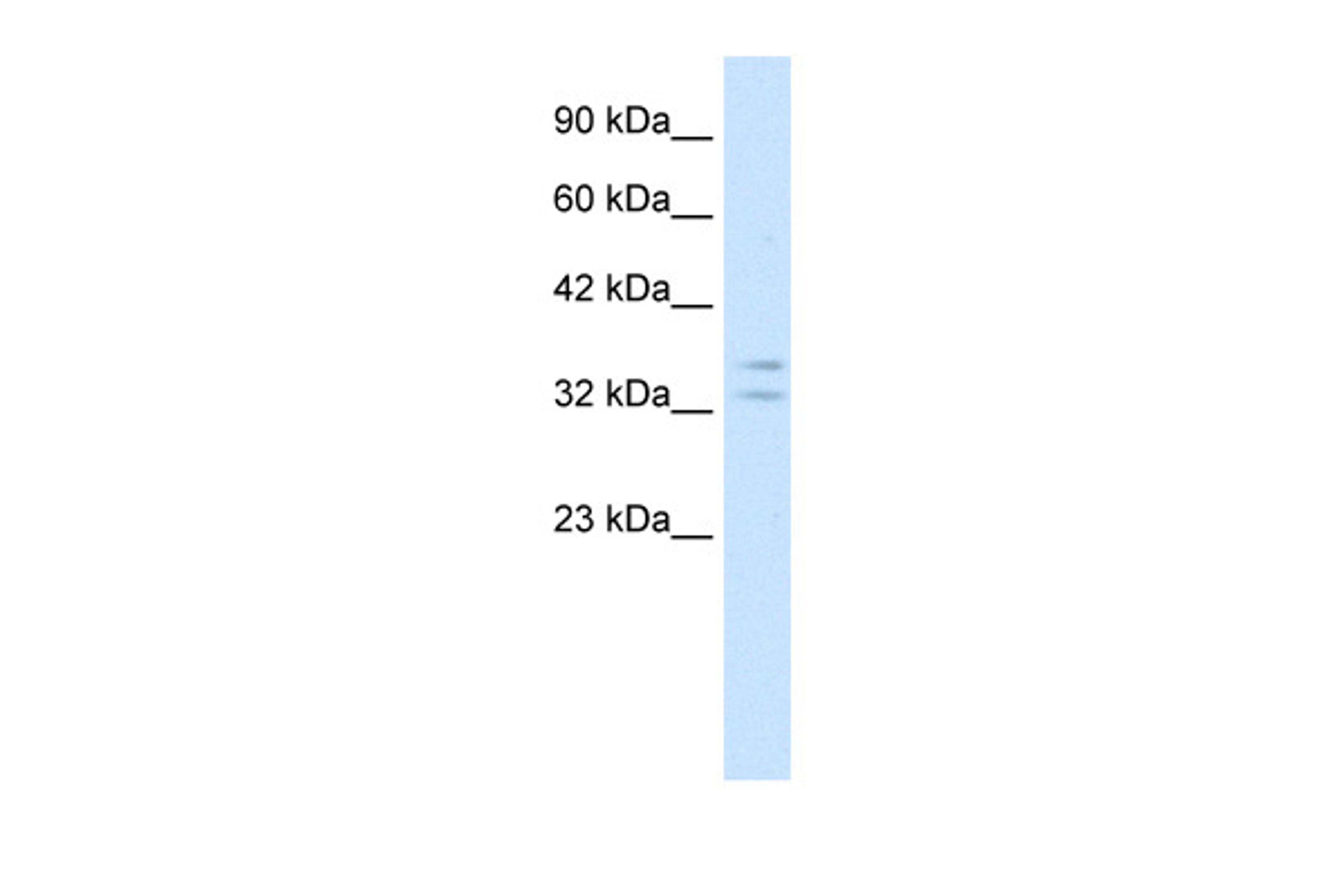 Antibody used in WB on Human Jurkat 1 ug/ml.