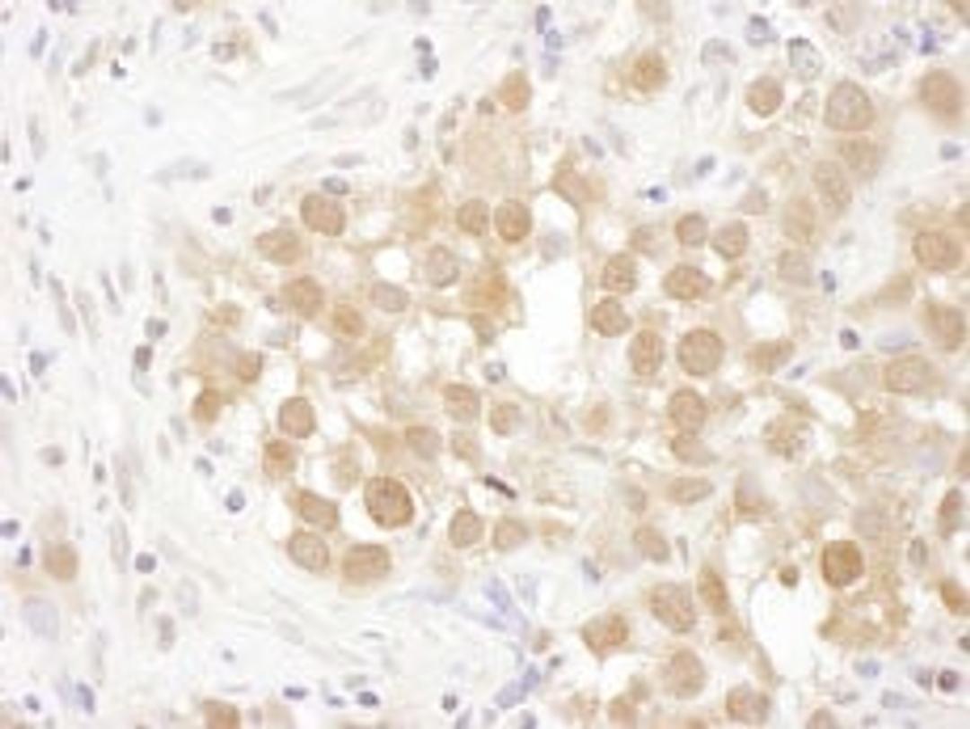 Detection of human MGEA5 by immunohistochemistry.