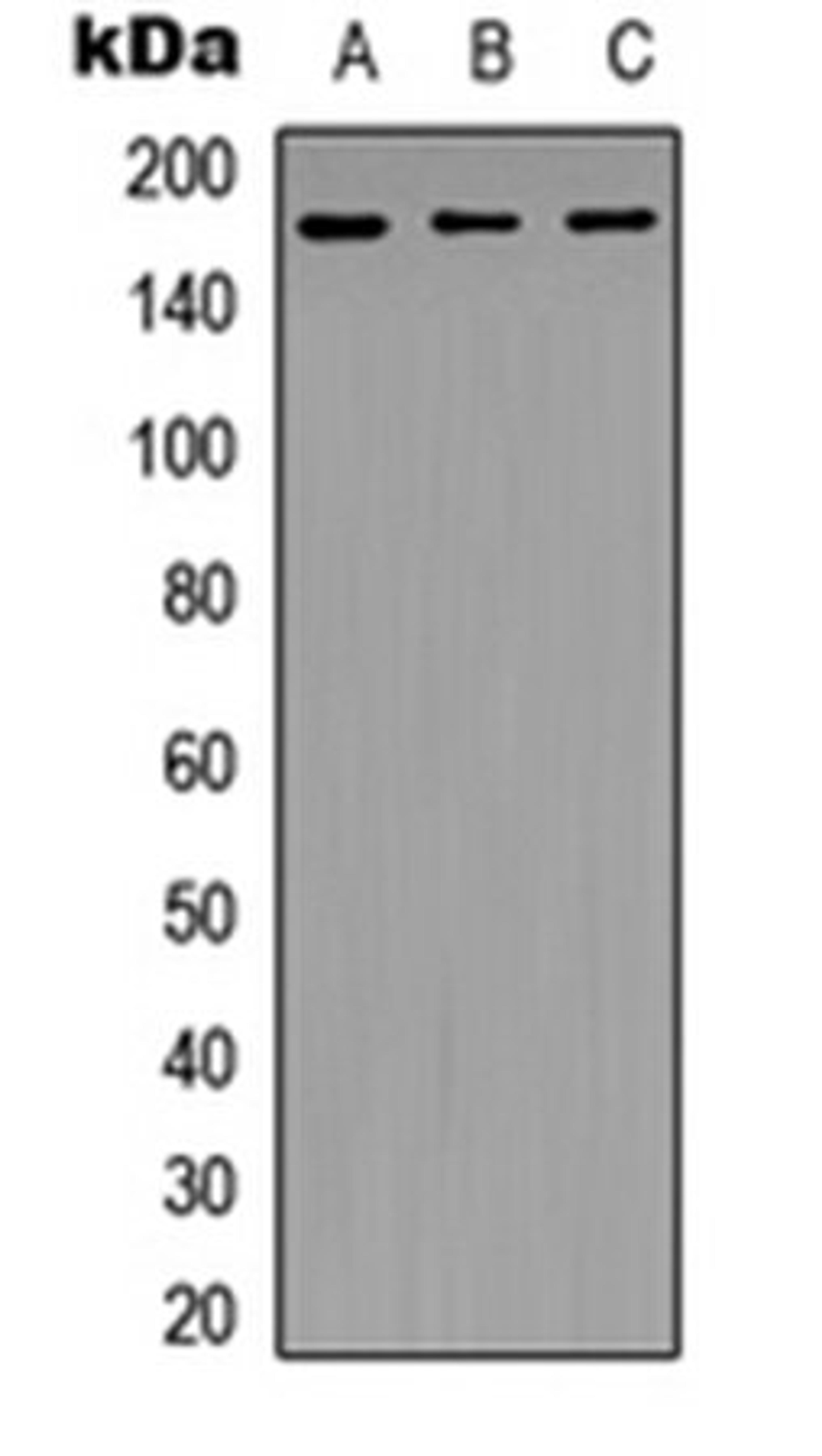 Western blot analysis of HT29 (Lane 1), Jurkat (Lane 2), HeLa (Lane 3) whole cell lysates using NFAT5 antibody