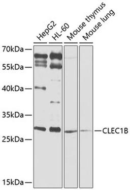 Western blot - CLEC1B antibody (A9971)