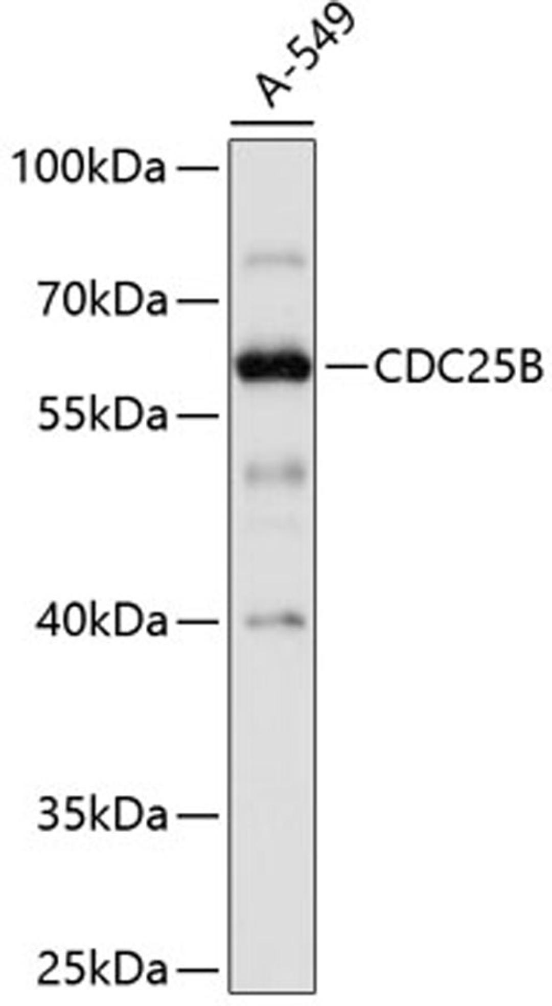 Western blot - CDC25B antibody (A0534)