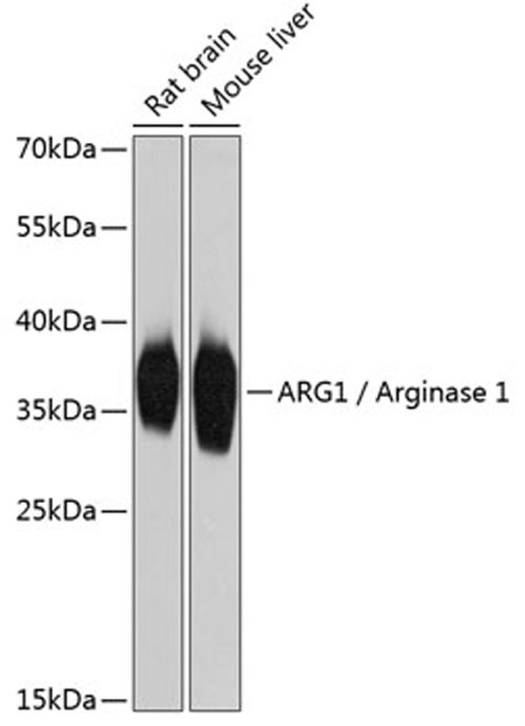 Western blot - ARG1 / Arginase 1 Antibody (A1847)