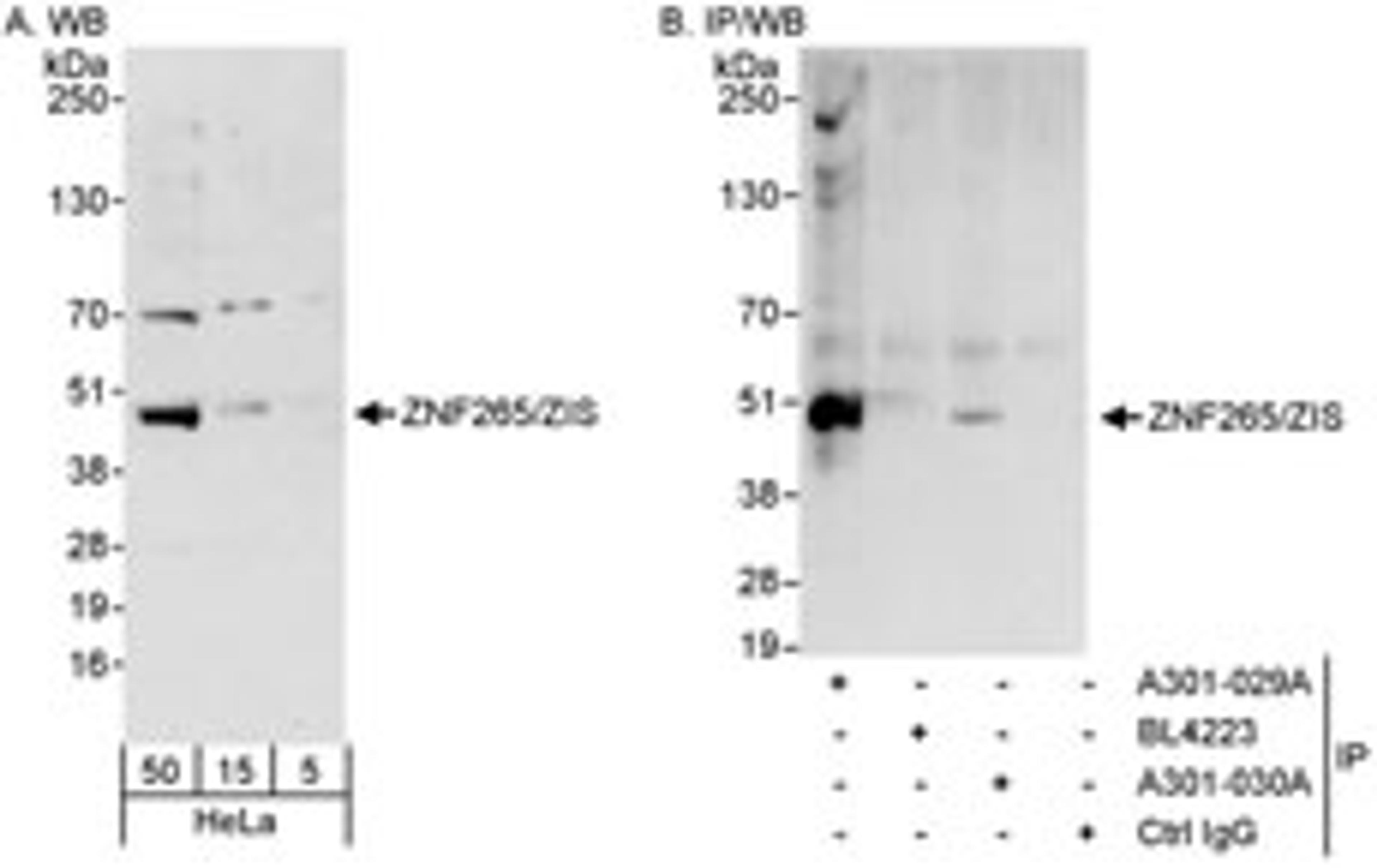 Detection of human ZNF265/ZIS by western blot and immunoprecipitation.