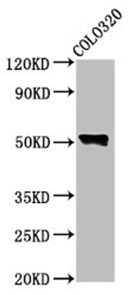Western Blot. Positive WB detected in: Colo320 whole cell lysate. All lanes: WAS antibody at 4.6µg/ml. Secondary. Goat polyclonal to rabbit IgG at 1/50000 dilution. Predicted band size: 53 kDa. Observed band size: 53 kDa