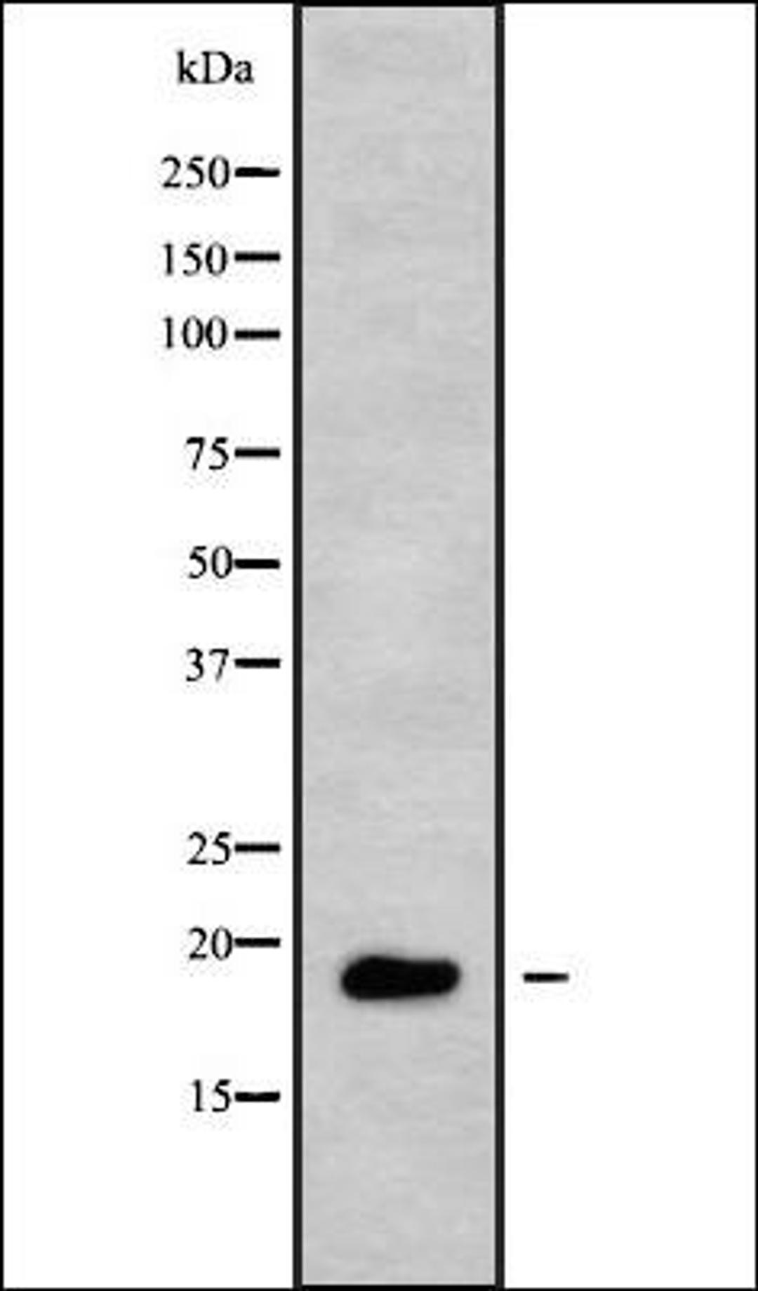 Western blot analysis of HUVEC whole cell lysates using TNFRSF13C antibody