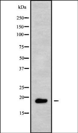 Western blot analysis of HUVEC whole cell lysates using TNFRSF13C antibody