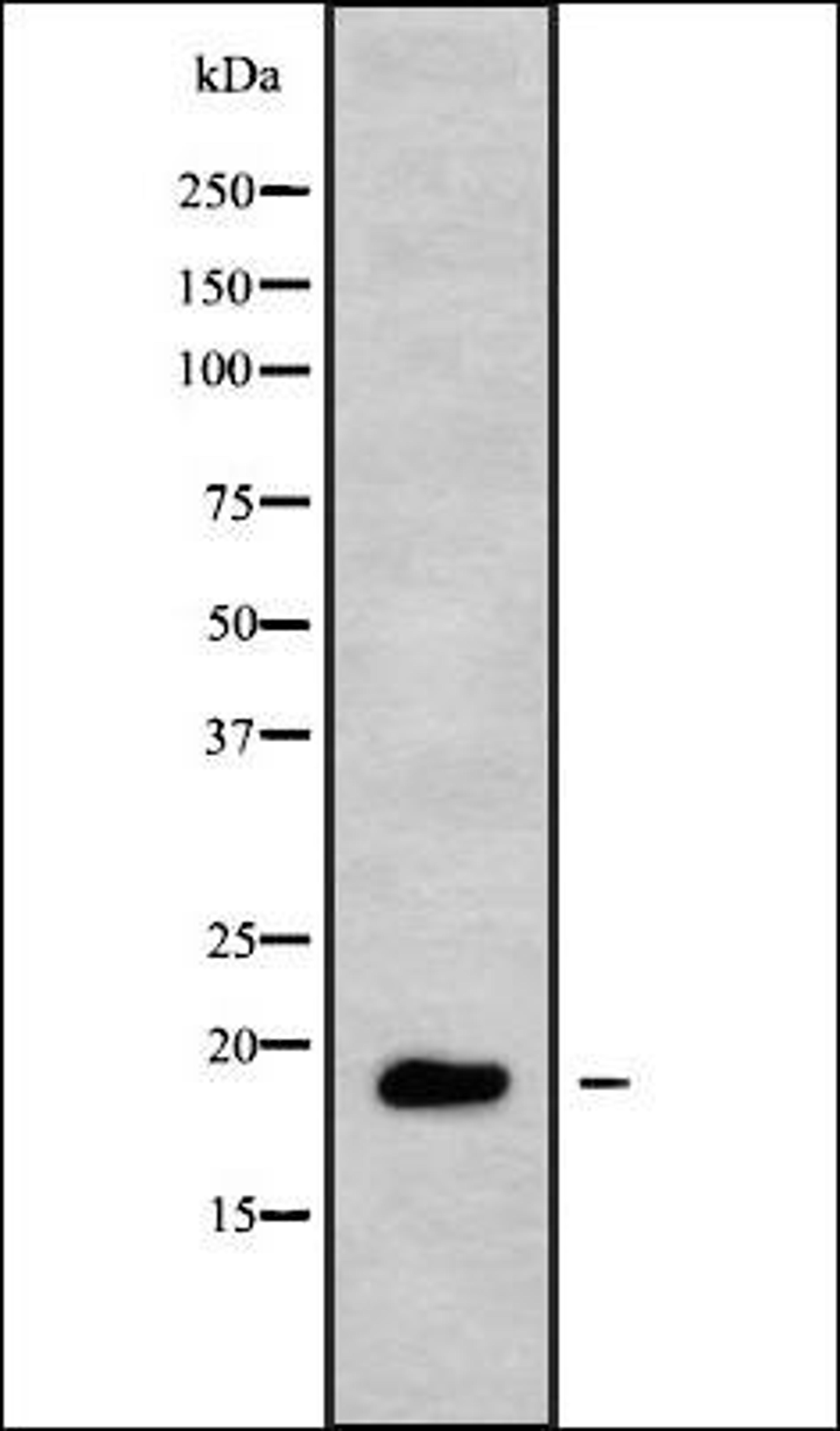 Western blot analysis of HUVEC whole cell lysates using TNFRSF13C antibody