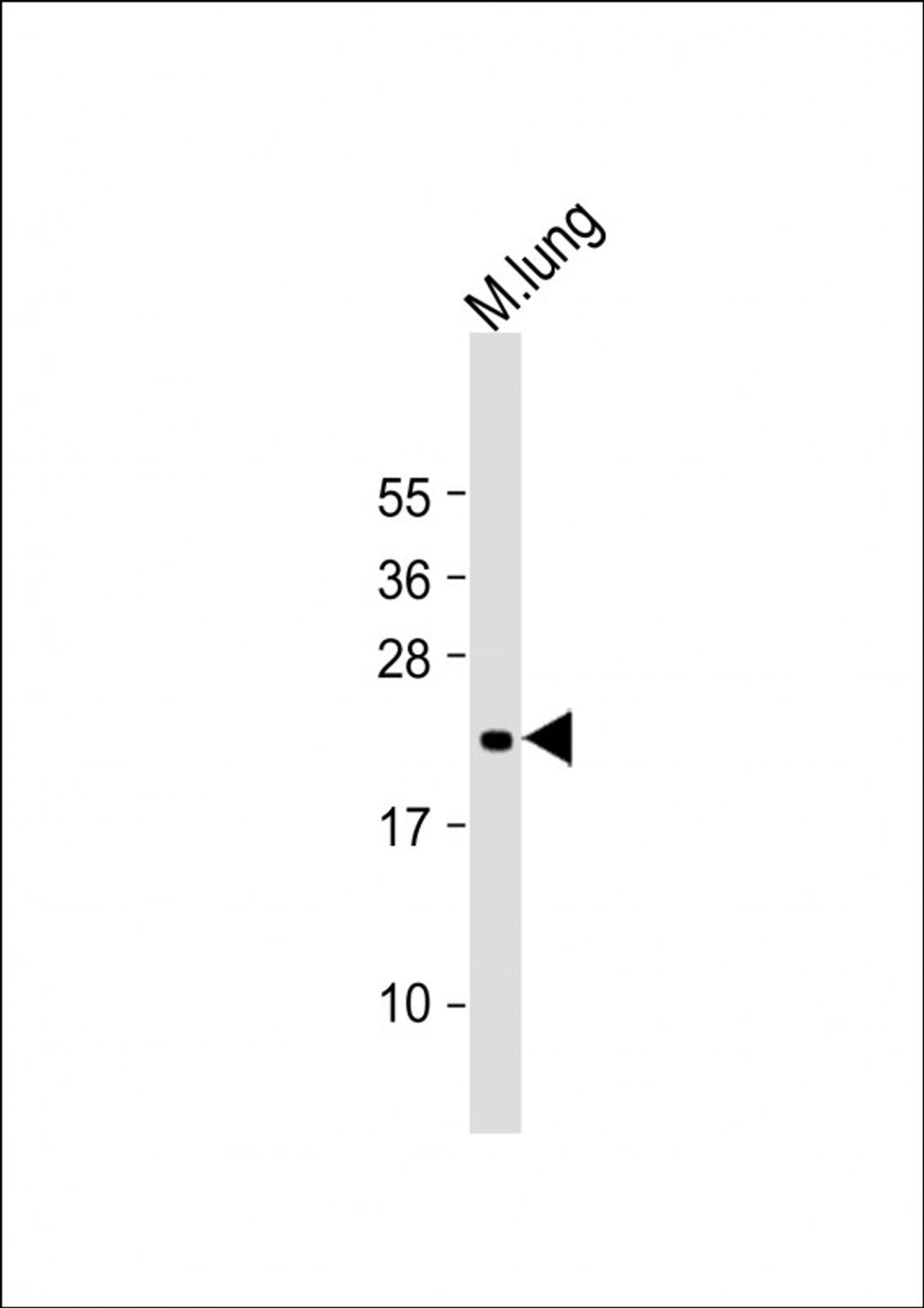 Western Blot at 1:2000 dilution + mouse lung lysate Lysates/proteins at 20 ug per lane.