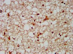 IHC image of CSB-PA836272LA01HU diluted at 1:300 and staining in paraffin-embedded human brain tissue performed on a Leica BondTM system. After dewaxing and hydration, antigen retrieval was mediated by high pressure in a citrate buffer (pH 6.0). Section was blocked with 10% normal goat serum 30min at RT. Then primary antibody (1% BSA) was incubated at 4&deg;C overnight. The primary is detected by a biotinylated secondary antibody and visualized using an HRP conjugated SP system.