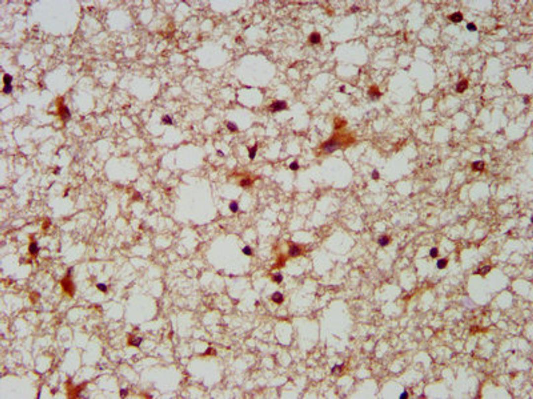 IHC image of CSB-PA836272LA01HU diluted at 1:300 and staining in paraffin-embedded human brain tissue performed on a Leica BondTM system. After dewaxing and hydration, antigen retrieval was mediated by high pressure in a citrate buffer (pH 6.0). Section was blocked with 10% normal goat serum 30min at RT. Then primary antibody (1% BSA) was incubated at 4°C overnight. The primary is detected by a biotinylated secondary antibody and visualized using an HRP conjugated SP system.