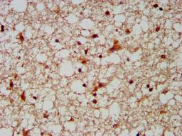 IHC image of CSB-PA836272LA01HU diluted at 1:300 and staining in paraffin-embedded human brain tissue performed on a Leica BondTM system. After dewaxing and hydration, antigen retrieval was mediated by high pressure in a citrate buffer (pH 6.0). Section was blocked with 10% normal goat serum 30min at RT. Then primary antibody (1% BSA) was incubated at 4°C overnight. The primary is detected by a biotinylated secondary antibody and visualized using an HRP conjugated SP system.