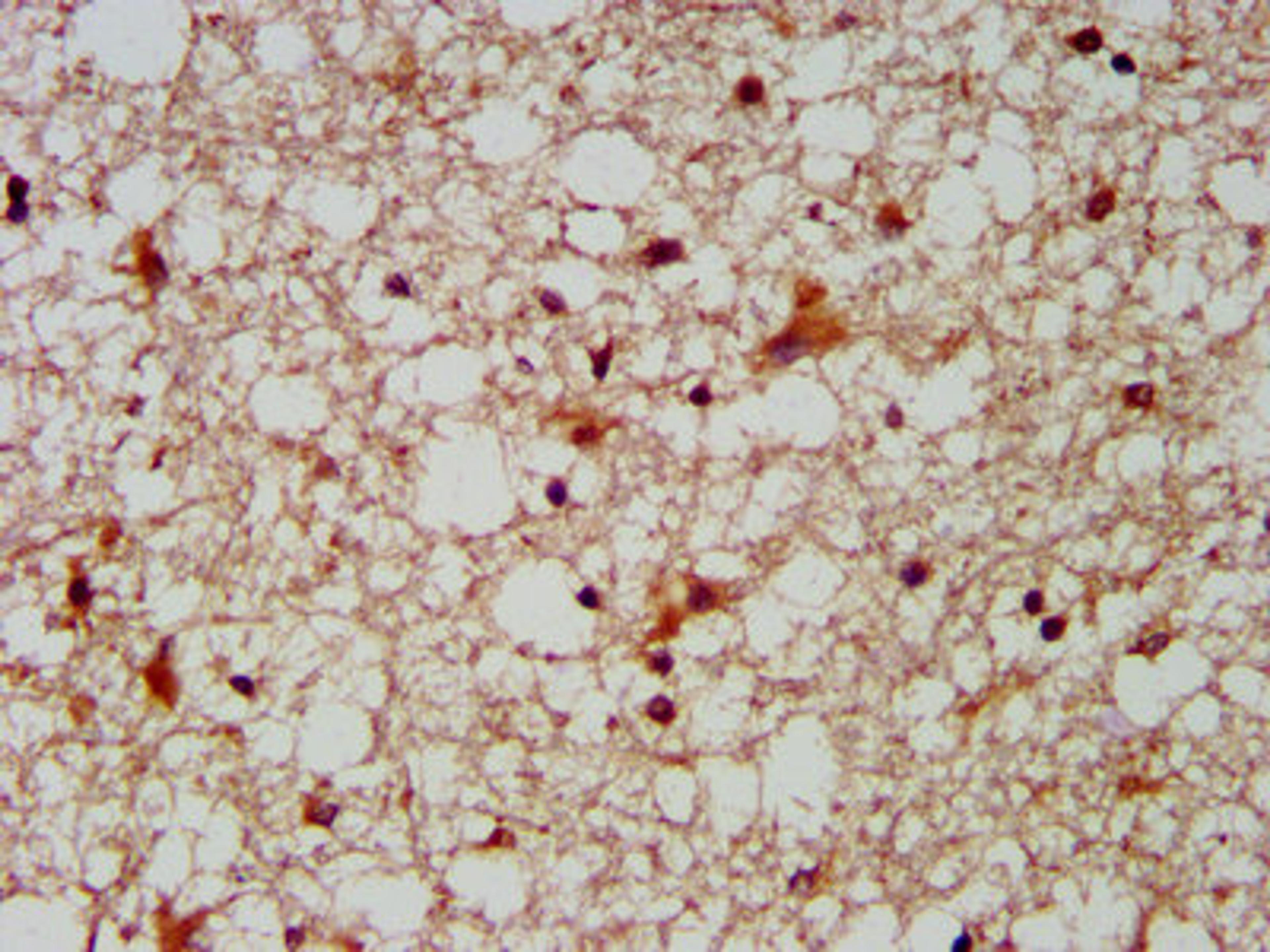 IHC image of CSB-PA836272LA01HU diluted at 1:300 and staining in paraffin-embedded human brain tissue performed on a Leica BondTM system. After dewaxing and hydration, antigen retrieval was mediated by high pressure in a citrate buffer (pH 6.0). Section was blocked with 10% normal goat serum 30min at RT. Then primary antibody (1% BSA) was incubated at 4°C overnight. The primary is detected by a biotinylated secondary antibody and visualized using an HRP conjugated SP system.