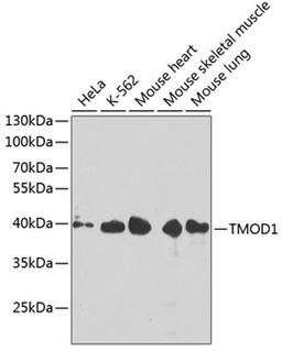 Western blot - TMOD1 antibody (A4160)