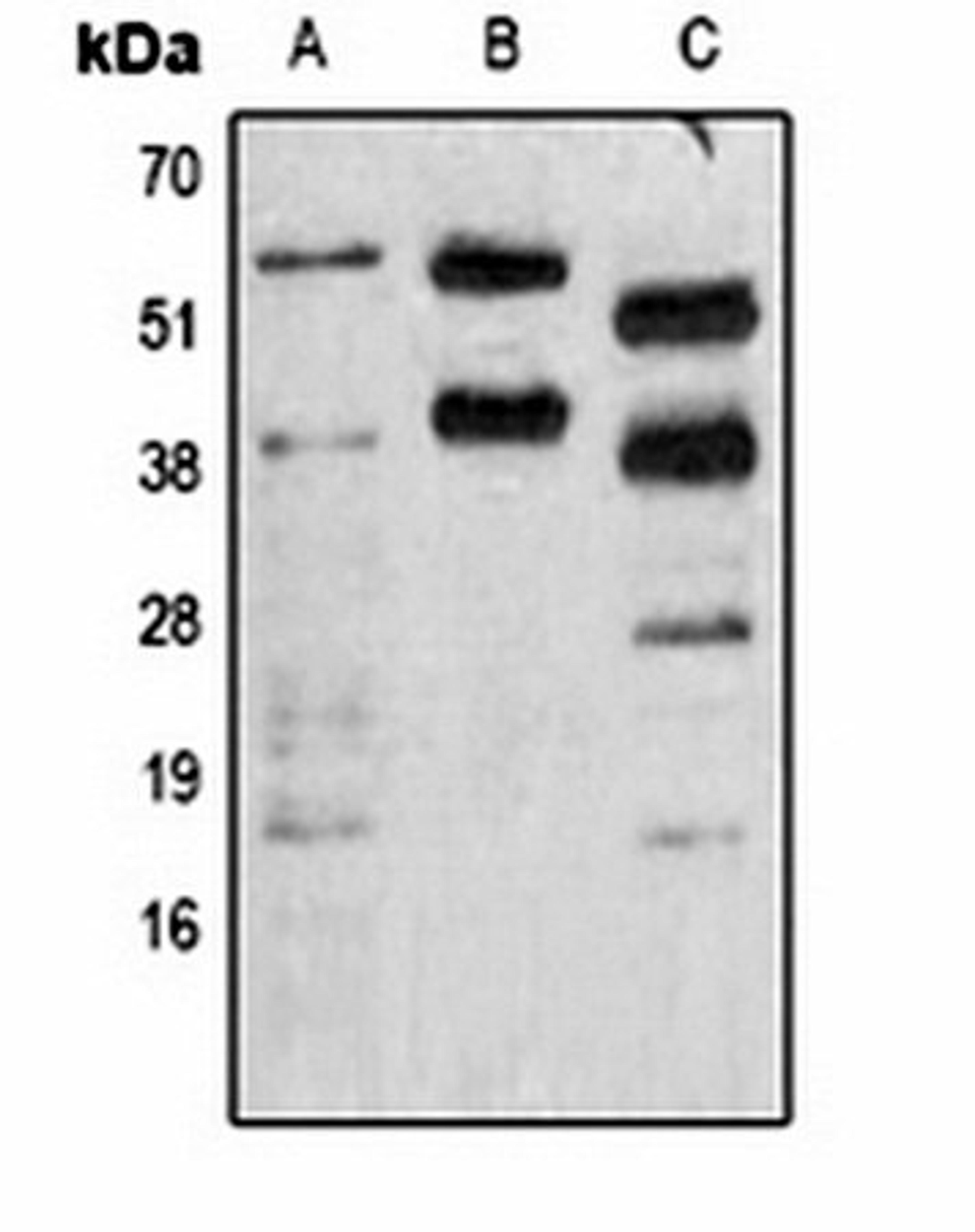 Western blot analysis of Jurkat (Lane 1), mouse brain (Lane 2), rat brain (Lane 3) whole cell lysates using Phosphoserine antibody